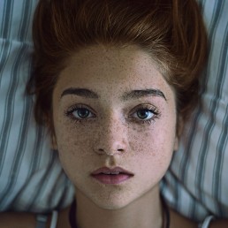 girl-face-with-freckles-square-uai-258x258